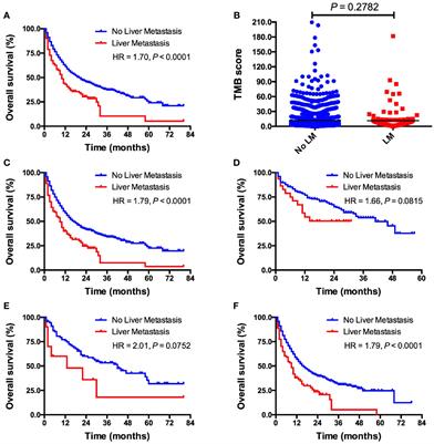 Pan-Cancer Analysis Identifies Liver Metastases as Negative Predictive Factor for Immune Checkpoint Inhibitors Treatment Outcome